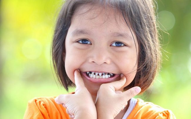 تشخیص شکستگی دندان کودکان