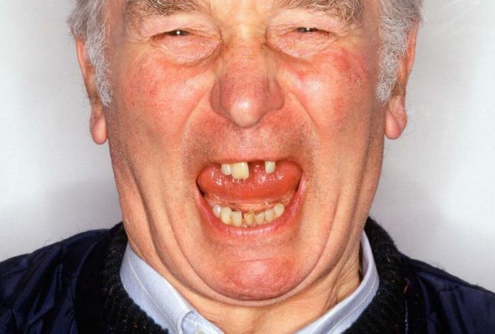 مراقبت از دهان و دندان در پیری