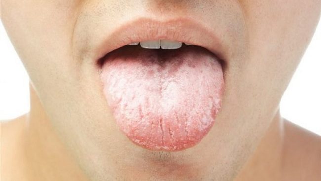 دلایل بوی بد دهان چیست